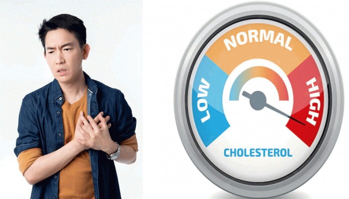 High Cholesterol: ಕೆಟ್ಟ ಕೊಲೆಸ್ಟ್ರಾಲ್‌ನಿಂದ ಮುಕ್ತಿ ಪಡೆಯಲು ಈ ಆಹಾರಗಳನ್ನು ತಪ್ಪದೇ ಸೇವಿಸಿ
