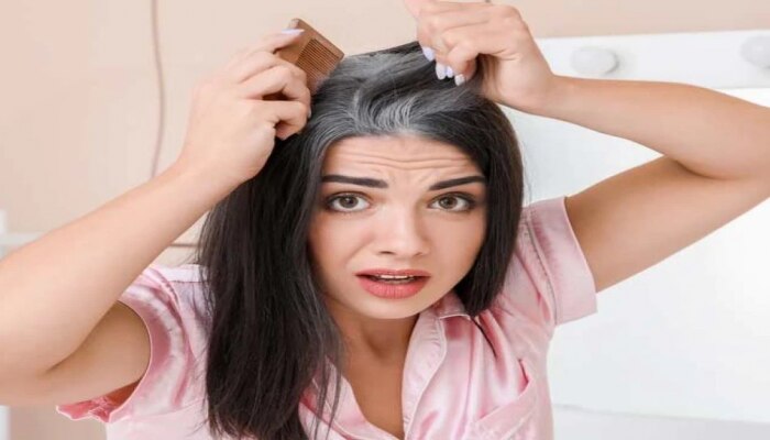 hair care tips make hair black with the help of gooseberry | ಬಿಳಿ ಕೂದಲು  ಸಮಸ್ಯೆಗೆ ನೆಲ್ಲಿಕಾಯಿ ಹೇರ್ ಪ್ಯಾಕ್, 2 ದಿನದಲ್ಲಿ ಕಪ್ಪಾಗುತ್ತೆ ಕೂದಲು! Health News  in Kannada