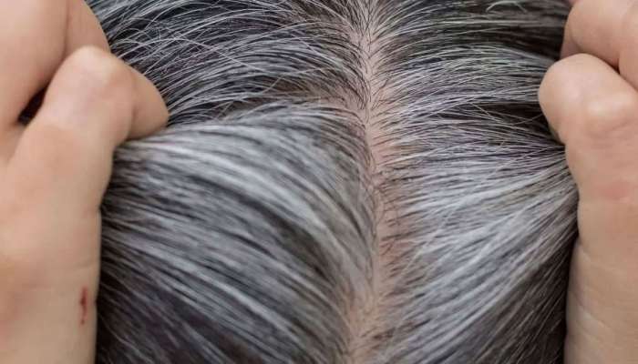 Grey Hair remedy: ಬಿಳಿ ಕೂದಲನ್ನು ನೈಸರ್ಗಿಕವಾಗಿ ಕಪ್ಪಾಗಿಸಲು ಈ ಒಂದು ಪುಡಿ ಸಾಕು..! 