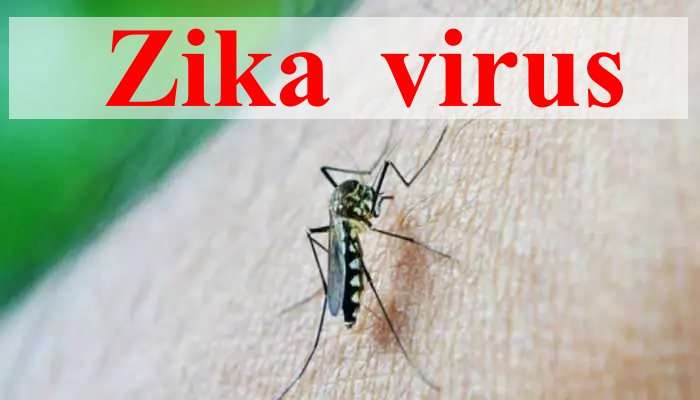 Zika virus: ರಾಜ್ಯದಲ್ಲಿ ಮೊದಲ ʼಝಿಕಾ ವೈರಸ್ʼ ಪ್ರಕರಣ ಪತ್ತೆ.. 5 ವರ್ಷದ ಬಾಲಕಿಗೆ ತಗುಲಿದ ಮಹಾಮಾರಿ