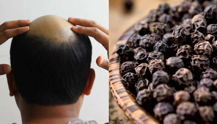 Black pepper is the solution for baldness | ಬೋಳು ತಲೆ ಸಮಸ್ಯೆಗೆ  ಕರಿಮೆಣಸಿನಲ್ಲಿದೆ ಪರಿಹಾರ Health News in Kannada