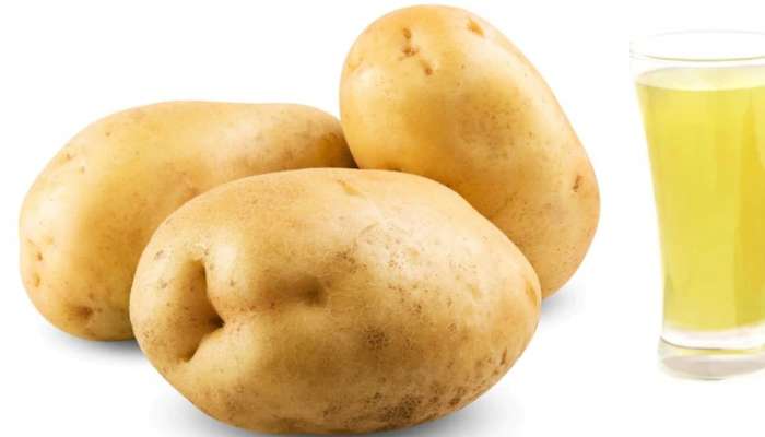 Potato Juice Benefits: ಈ ಗಂಭೀರ ಸಮಸ್ಯೆಗಳಿಗೆ ರಾಮಬಾಣ ಅಲೂಗಡ್ಡೆ ಜ್ಯೂಸ್ 