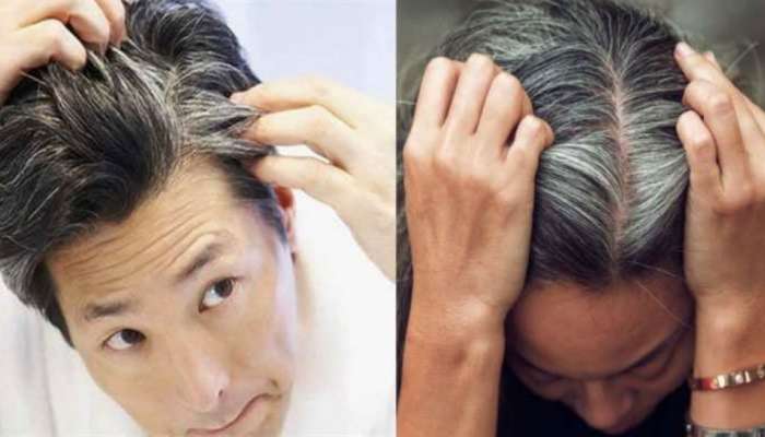 Home remedy to make white hair black permanently | ಬಿಳಿ ಕೂದಲನ್ನು ಶಾಶ್ವತವಾಗಿ ಕಪ್ಪಾಗಿಸಲು ಇಲ್ಲಿದೆ ಮನೆಮದ್ದು Lifestyle News in Kannada Home remedy to make white hair black permanently | ಬಿಳಿ ಕೂದಲನ್ನು ಶಾಶ್ವತವಾಗಿ ಕಪ್ಪಾಗಿಸಲು ಇಲ್ಲಿದೆ ಮನೆಮದ್ದು Lifestyle News in Kannada