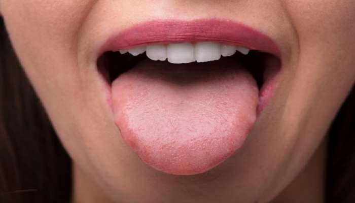 Tongue Colour: ನಾಲಿಗೆಯ ಬಣ್ಣ-ಆಕಾರದಿಂದ ತಿಳಿಯಬಹುದು ಮನುಷ್ಯನ ಭವಿಷ್ಯ