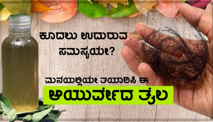 anti hair fall remedy applay this oil mixture to your head and massage just  five minutes you will get rid of frequent hairfall problem Anti-Hairfall  Oil: ಈ ಎಣ್ಣೆ ಹಚ್ಚಿ ಕೇವಲ 5 ನಿಮಿಷ