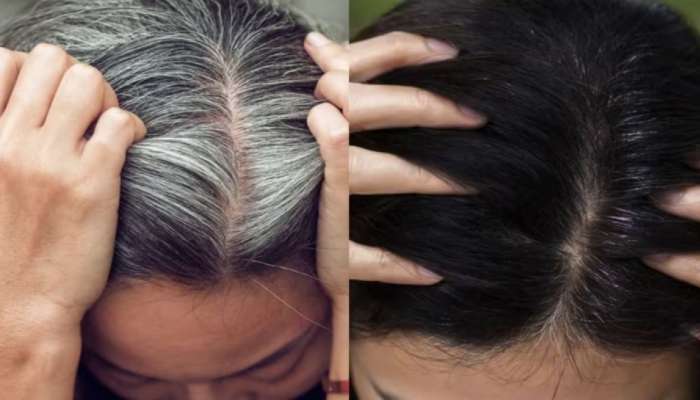 White hair will turn black naturally using these 3 things | ಈ 3 ವಸ್ತುಗಳನ್ನು ಬಳಸಿ ಬಿಳಿ ಕೂದಲು ನೈಸರ್ಗಿಕವಾಗಿ ಕಪ್ಪಾಗುತ್ತದೆ Health News in Kannada White hair will turn black naturally using these 3 things | ಈ 3 ವಸ್ತುಗಳನ್ನು ಬಳಸಿ ಬಿಳಿ ಕೂದಲು ನೈಸರ್ಗಿಕವಾಗಿ ಕಪ್ಪಾಗುತ್ತದೆ Health News in Kannada