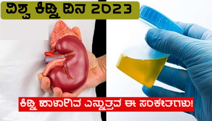 World Kidney Day 2023: ಕಿಡ್ನಿ ಸಮಸ್ಯೆ ಇದ್ದರೆ ಶರೀರ ಈ ಸಂಕೇತಗಳನ್ನು ನೀಡುತ್ತದೆ, ನಿರ್ಲಕ್ಷಿಸಬೇಡಿ!