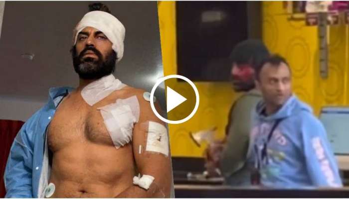 Aman Dhaliwal : ನಟನ ಮೇಲೆ ಚಾಕುವಿನಿಂದ ಮಾರಣಾಂತಿಕ ದಾಳಿ..! ರಕ್ತ ಸುರಿಯುತ್ತಿದ್ದರೂ ಶತ್ರುವನ್ನು ಬಿಡಲಿಲ್ಲ