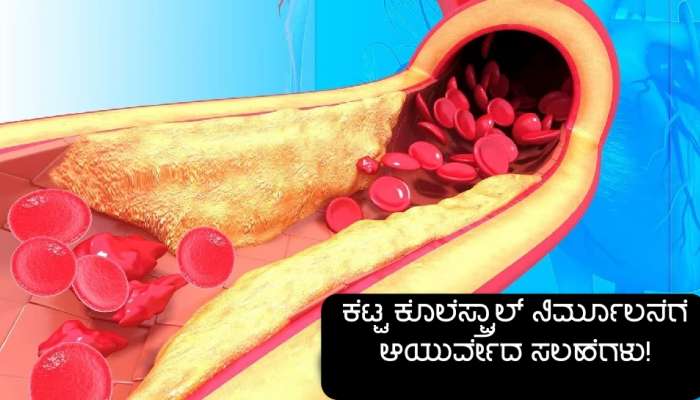 ರಕ್ತ ನಾಳಗಳಲ್ಲಿನ ಮೊಂಡು ಜಿಡ್ಡು ಹಲವು ಗಂಭೀರ ಕಾಯಿಲೆಗಳಿಗೆ ಕಾರಣ, ಇಂದೇ ಅದನ್ನು ಈ ವಿಧಾನದಿಂದ ಹೊರಹಾಕಿ!