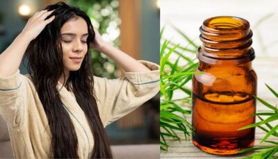 this magicali oil is a finest remedy for many hair related issues including hairfall problem ಬೊಕ್ಕ ತಲೆ ಸಮಸ್ಯೆ ಸೇರಿದಂತೆ ಹಲವು ಕೂದಲಿನ ಸಮಸ್ಯೆಗಳಿಗೆ ಸಂಜೀವನಿ ಈ ಒಂದೇ ಒಂದು ಎಣ್ಣೆ! | Health News in ...