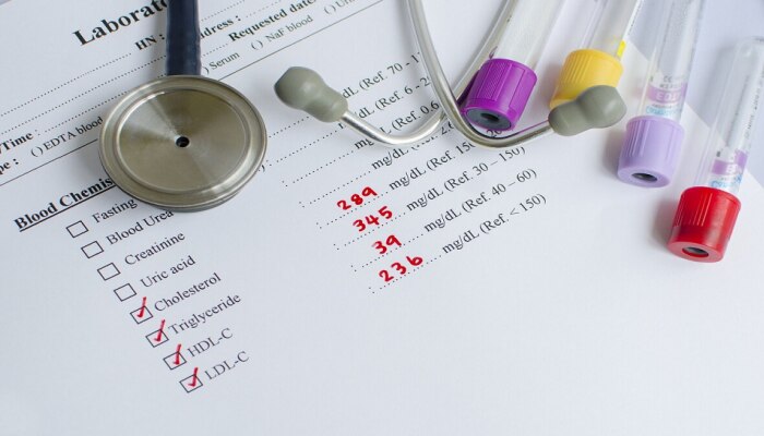 Cholesterol Test ಮಾಡಿಸಿಕೊಳ್ಳಬೇಕೆ? ಈ 5 ಅತ್ಯಾವಶ್ಯಕ ಸಂಗತಿಗಳನ್ನು ತಿಳಿದುಕೊಳ್ಳಿ! title=