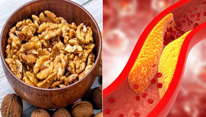 Bad Cholesterol Tips: ಈ ಡ್ರೈಫ್ರೂಟ್ ಅನ್ನು ಈ ರೀತಿ ಸೇವಿಸಿದರೆ, ರಕ್ತ ನಾಳಗಳಲ್ಲಿನ ಕೆಟ್ಟ ಕೊಲೆಸ್ಟ್ರಾಲ್ ಮಂಗಮಾಯ ಗ್ಯಾರಂಟಿ!