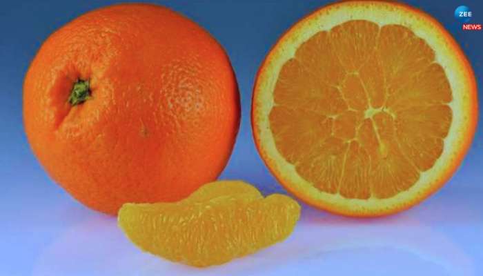 Health benefits of oranges: ಚಳಿಗಾಲದಲ್ಲಿ ಕಿತ್ತಳೆ ಸೇವನೆಯಿಂದ ಆರೋಗ್ಯಕ್ಕಿದೆ ಈ ಅದ್ಭುತ ಪ್ರಯೋಜನಗಳು 