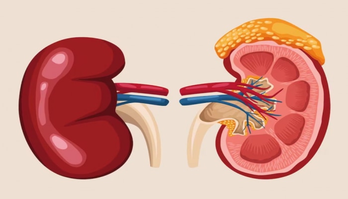  Rare Kidney Disease ನಿಂದ ಬಳಲುತ್ತಿರುವ ಜನರಿಗಿದೆ ಮೂತ್ರಪಿಂಡ ವೈಫಲ್ಯದ ಹೆಚ್ಚಿನ ಅಪಾಯ..!