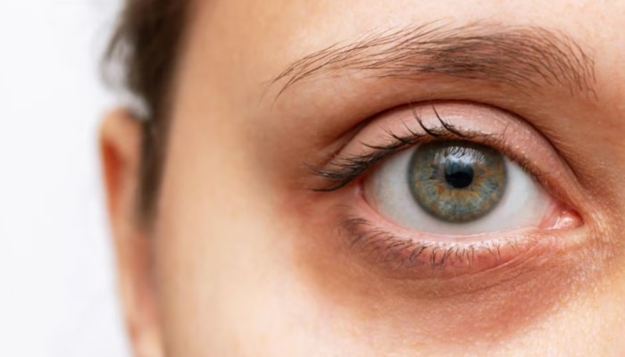 Weak Eyesight: ಈ ಪೋಷಕಾಂಶಗಳ ಕೊರತೆಯಿಂದಾಗಿ ನಿಮ್ಮ ದೃಷ್ಟಿಹೀನವಾಗಬಹುದು...! 
