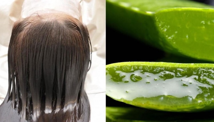 Aloe Vera for Hair Care: ಕೂದಲಿನ ಎಲ್ಲಾ ಸಮಸ್ಯೆಗಳಿಂದ ಮುಕ್ತಿ ನೀಡುತ್ತದೆ ಅಲೋವೆರಾ