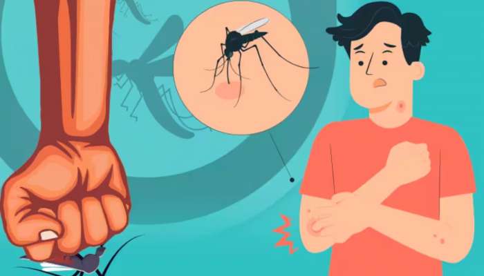 National Dengue Day 2024 : ಮಾರಕ ಡೆಂಗ್ಯೂ ನಿಯಂತ್ರಣಕ್ಕೆ ಇಲ್ಲಿವೆ ಸರಳ ಉಪಾಯಗಳು..! title=