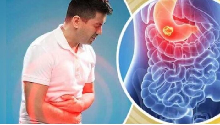 Health Tips: ಈ ಕಷಾಯ ಸೇವಿಸಿದ್ರೆ ಅಜೀರ್ಣ &amp; ಹೊಟ್ಟೆನೋವು ಮಂಗಮಾಯವಾಗುತ್ತದೆ!