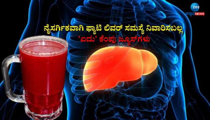 Fatty Liver: ಈ &#039;ಐದು&#039; ಬಗೆಯ ಕೆಂಪು ಬಣ್ಣದ ಜ್ಯೂಸ್‌ಗಳಿಂದ ಫ್ಯಾಟಿ ಲಿವರ್ ಸಮಸ್ಯೆಗೆ ಹೇಳಿಗೆ ಗುಡ್ ಬೈ! 