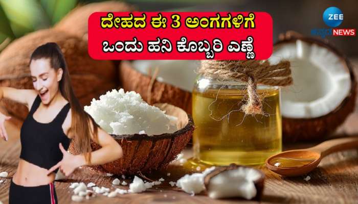 ನಿತ್ಯ ದೇಹದ ಈ 3 ಅಂಗಗಳಿಗೆ ಒಂದು ಹನಿ ಕೊಬ್ಬರಿ ಎಣ್ಣೆ ಹಾಕಿದ್ರೆ, ರೋಗಗಳು ಹತ್ತಿರವೂ ಸುಳಿಯಲ್ಲ: ವಾಚ್ ವಿಡಿಯೋ  title=