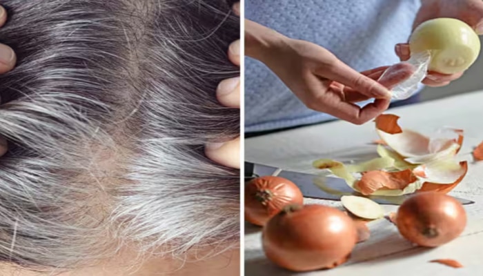  White Hair: ಅಡುಗೆಗೆ ಬಳಸುವ ಈ ಪದಾರ್ಥದಿಂದ ನಿಮ್ಮ ಕೂದಲನ್ನು ಕಪ್ಪಾಗಿಸಬಹುದು..! ಇಲ್ಲಿದೆ ಬಳಸುವ ವಿಧಾನ title=