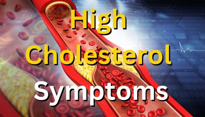 High Cholesterol Symptoms: ಈ ಅಧಿಕ ಕೊಲೆಸ್ಟ್ರಾಲ್ ಲಕ್ಷಣಗಳನ್ನು ಎಂದಿಗೂ ನಿರ್ಲಕ್ಷಿಸಬೇಡಿ 