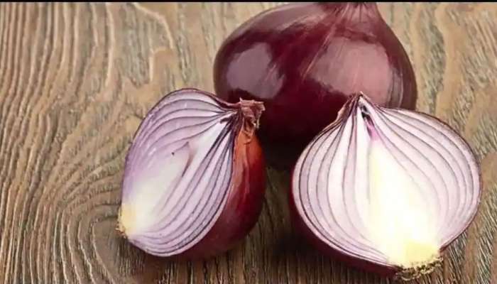 Onion Benefits: ಈರುಳ್ಳಿ ತಿನ್ನುವುದರಿಂದ ಸಿಗುತ್ತೆ ಅದ್ಭುತ ಪ್ರಯೋಜನ 