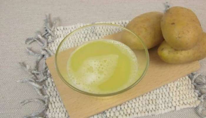 Potato Juice Benefits: ಆಲೂಗಡ್ಡೆ ರಸದಲ್ಲಿದೆ ಈ ಕಾಯಿಲೆಗಳಿಗೆ ಪರಿಹಾರ 