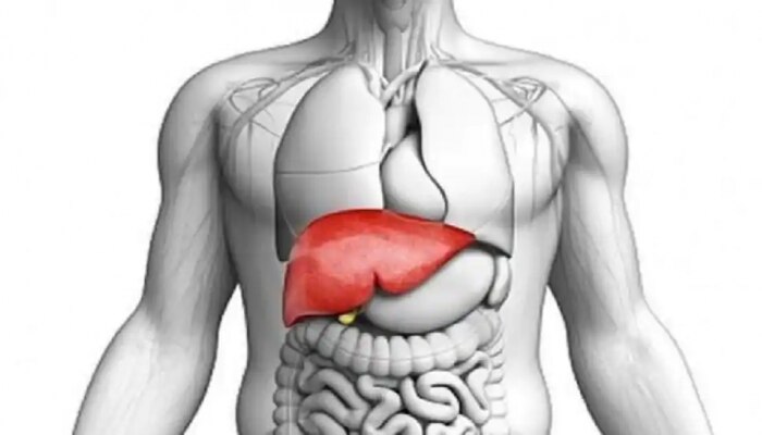 Fatty Liver Disease: ಕೇವಲ ಅಲ್ಕೋಹಾಲ್ ನಿಂದ ಮಾತ್ರ ಅಲ್ಲ, ಈ ಅಭ್ಯಾಸಗಳಿಂದಲೂ ಫ್ಯಾಟಿ ಲಿವರ್ ಸಮಸ್ಯೆ ಎದುರಾಗಬಹುದು